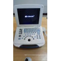 DW-580 ultrasound pregnancy & ultrasound scan machine